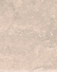 MC00476